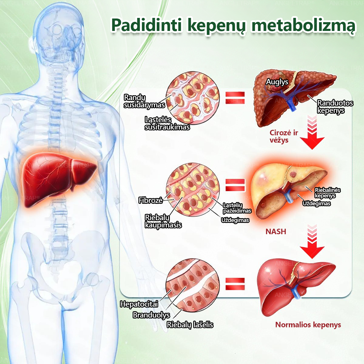 ⏰ Sveikiname! Atidarėte išskirtinį pasiūlymą ANGELTRAP®! Už jūsų užsakymą šiandien gausite papildomą 50 % nuolaidą! Spustelėkite žemiau esančią nuorodą ir pasinaudokite šiuo specialiu pasiūlymu — pasiūlymas netrukus baigs galioti! ⏰